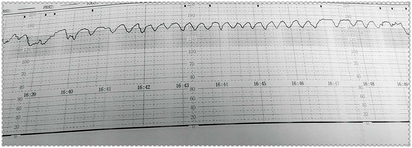 怀胎十月问题多, 规律产检不啰嗦, 胎动异常及时说, 胎心监护