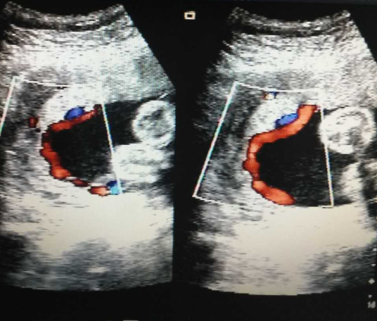 QQ截图20170626081810.png QQ截图20170626081810.png