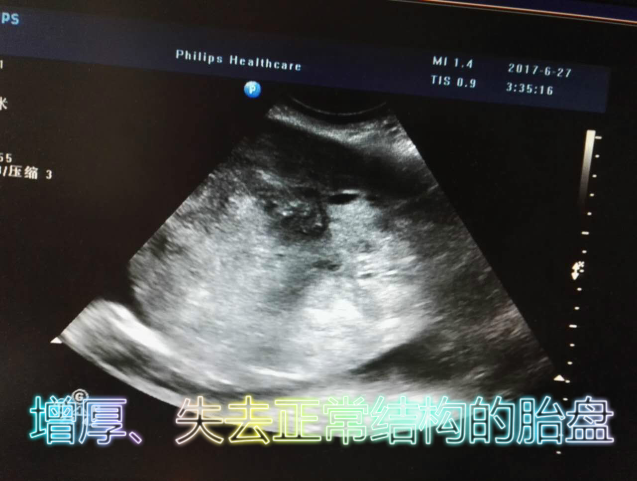 微信图片_20170720062426_meitu_2.jpg 微信图片_20170720062426_meitu_2.jpg