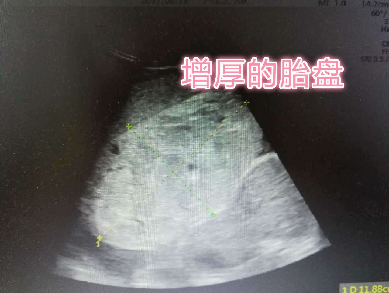 微信图片_20170720062438_meitu_1.jpg 微信图片_20170720062438_meitu_1.jpg