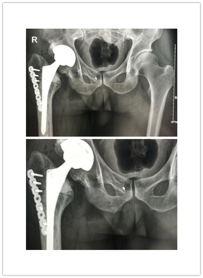 initpintu_副本.jpg initpintu_副本.jpg