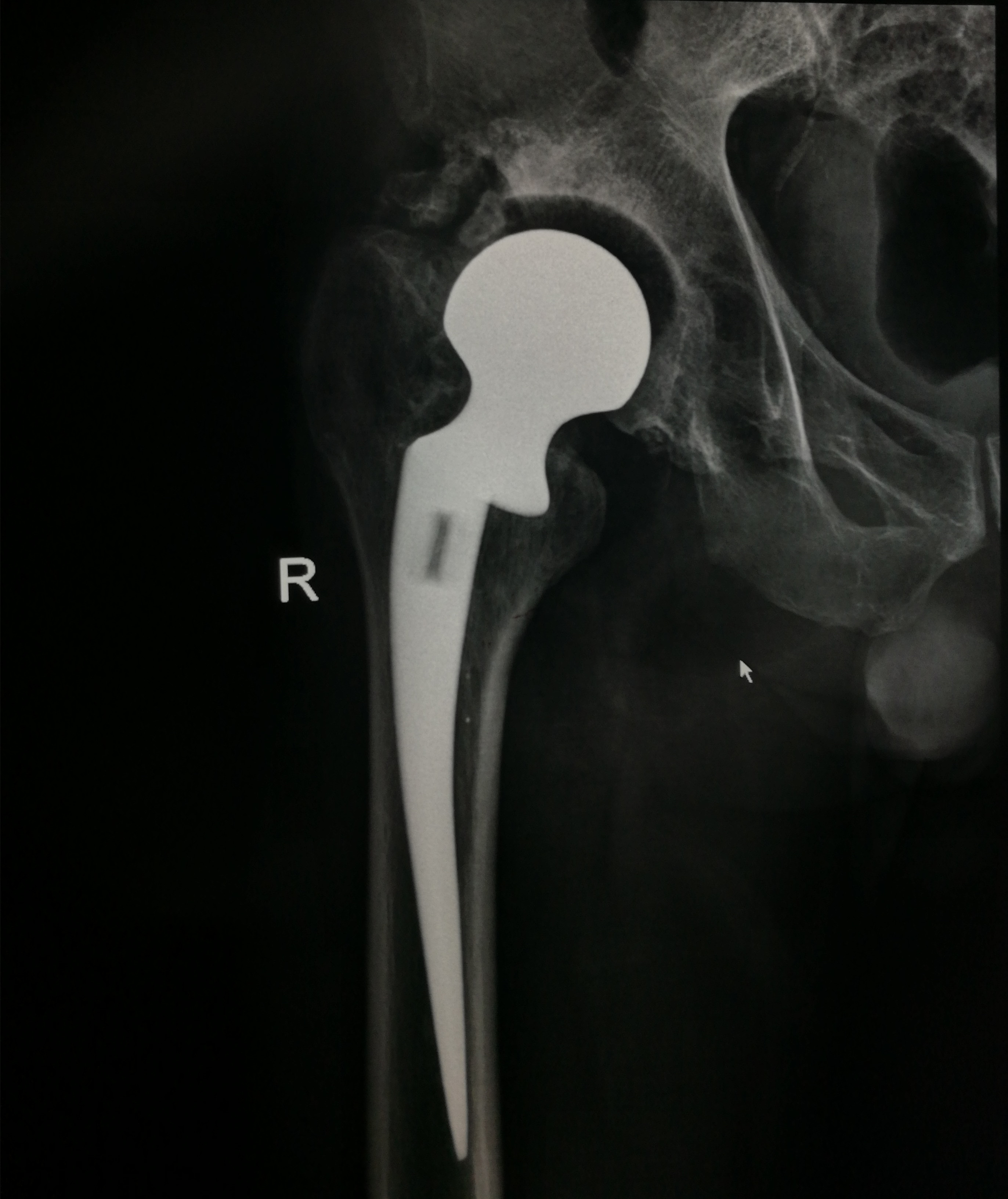 术前_副本.jpg 术前_副本.jpg