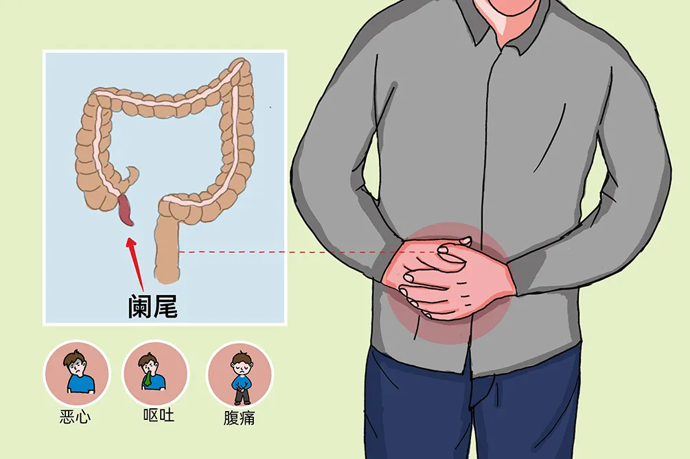 阑尾搞笑图片图片